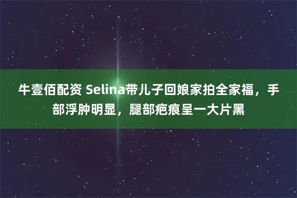 牛壹佰配资 Selina带儿子回娘家拍全家福，手部浮肿明显，腿部疤痕呈一大片黑